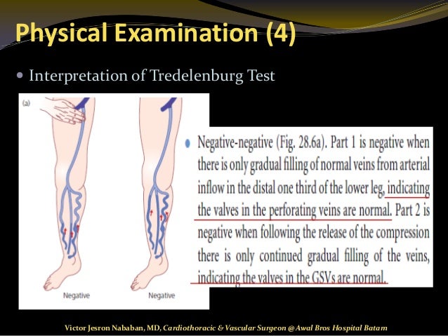 varicose vein examination varicose vein examination